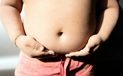  Obesity can raise depression risk among children, adolescents: Doctors