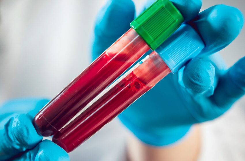  Simple blood test may predict future heart, kidney risk for diabetics