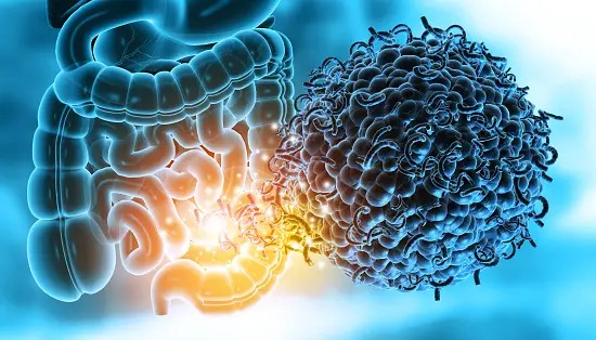  Study shows our gut microbes may determine bone health